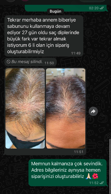 Müşteri mesajı